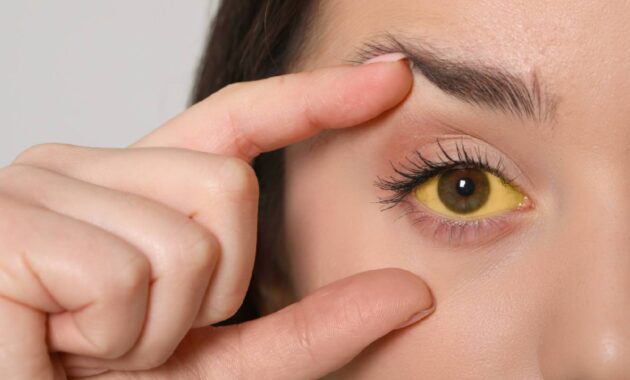 9 things your eyes tell you about your health