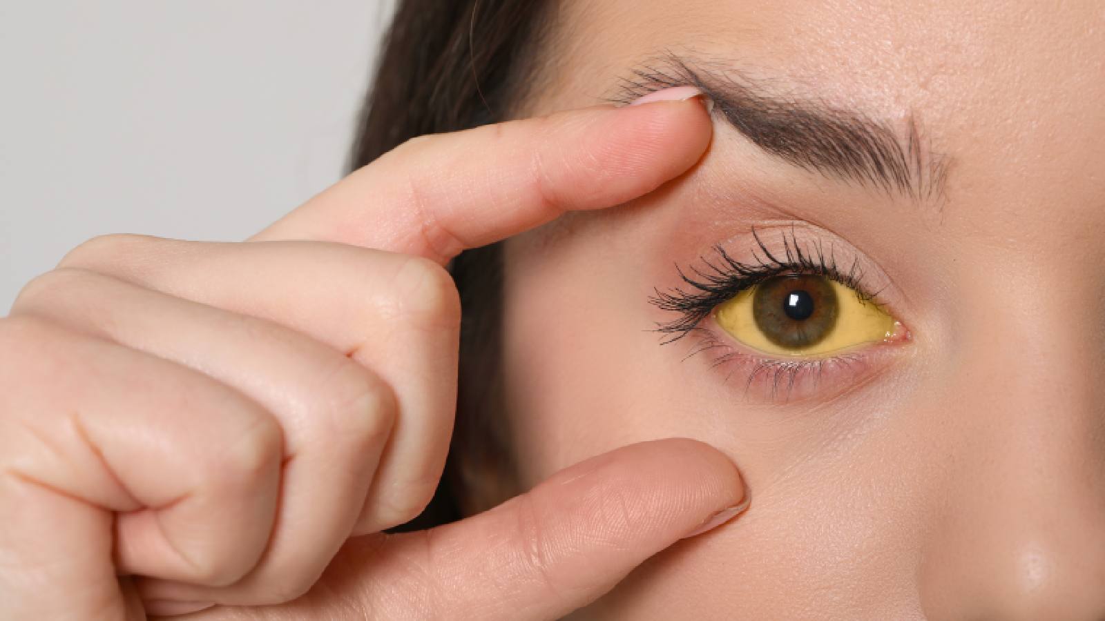 9 things your eyes tell you about your health