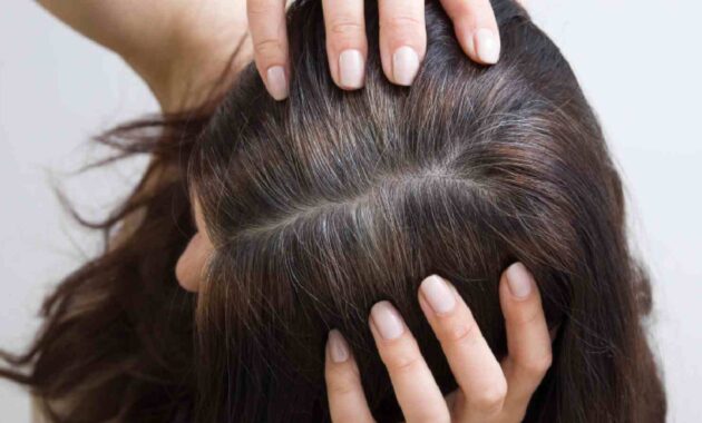 5 anti grey hair products to avoid premature greying of hair