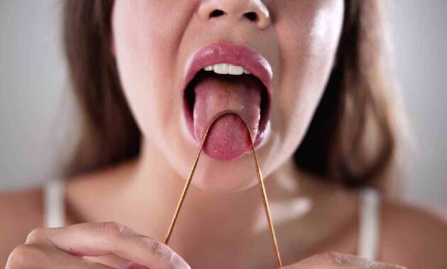 Tongue scraping: Benefits for oral hygiene and how to do it