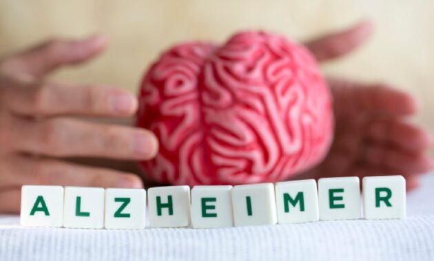 How to decrease stress to reduce Alzheimer’s disease risk?