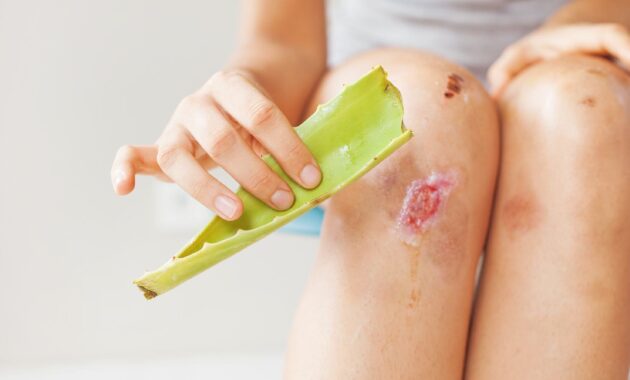 8 ways to heal wounds faster