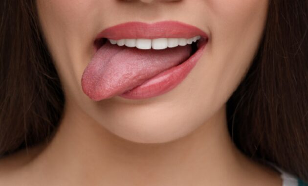 Yellow tongue: Why it happens and how to turn it pink again