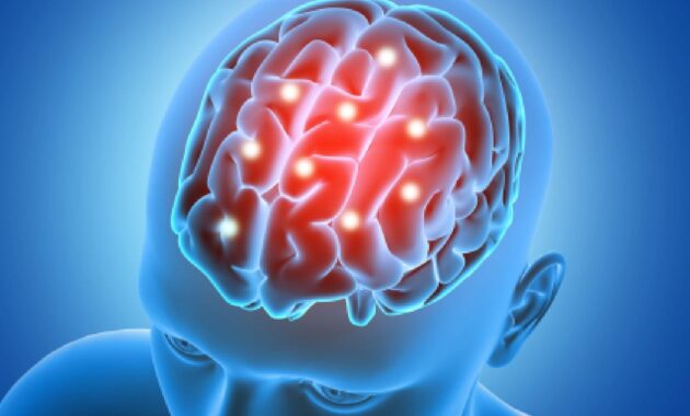 Symptoms of glioblastoma to watch out for