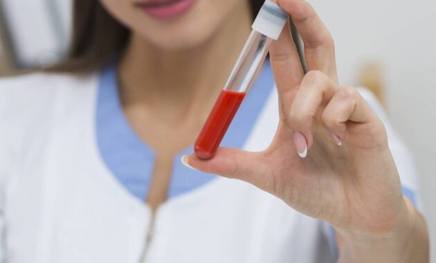 MCH levels in blood test: What does it mean?