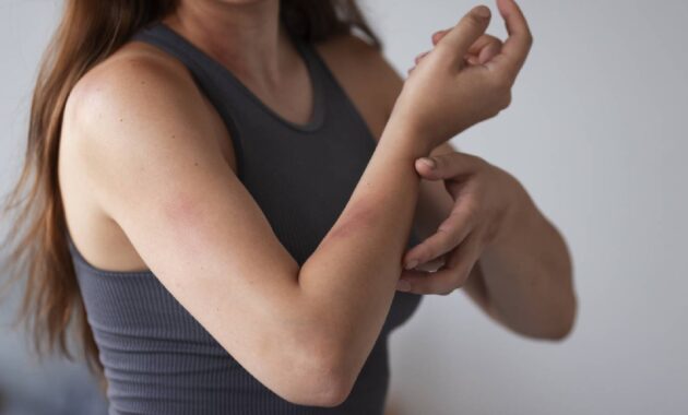 Skin rashes: Types, Causes, Diagnosis, Treatment