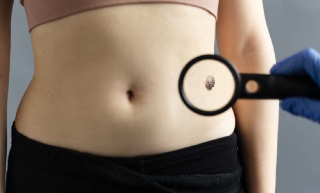 Belly button discharge: Causes and treatment