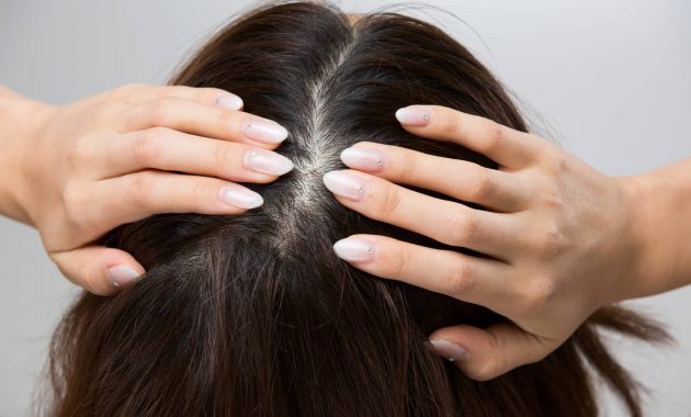 7 tips to manage excessive scalp sweating