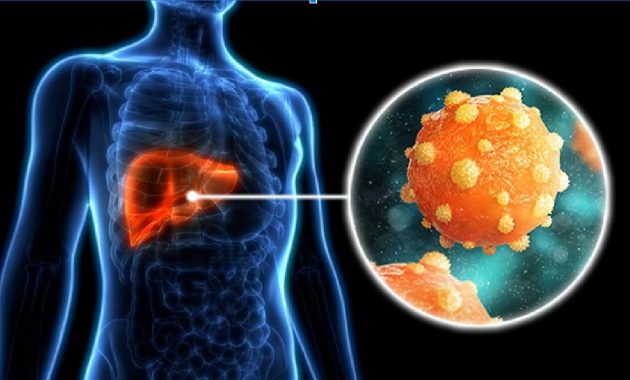 5 Uncommon Signs of Hepatitis B