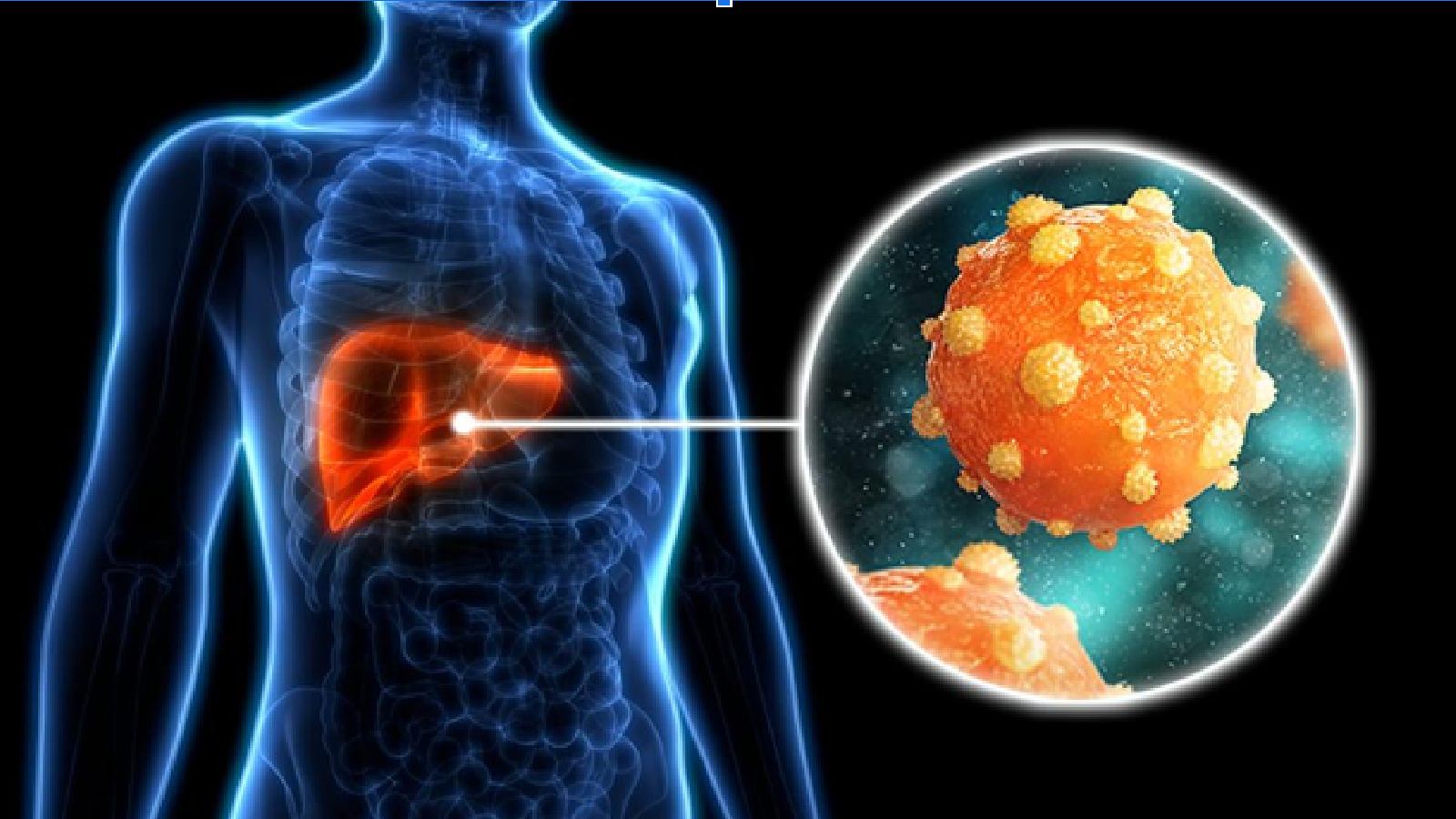 5 Uncommon Signs of Hepatitis B