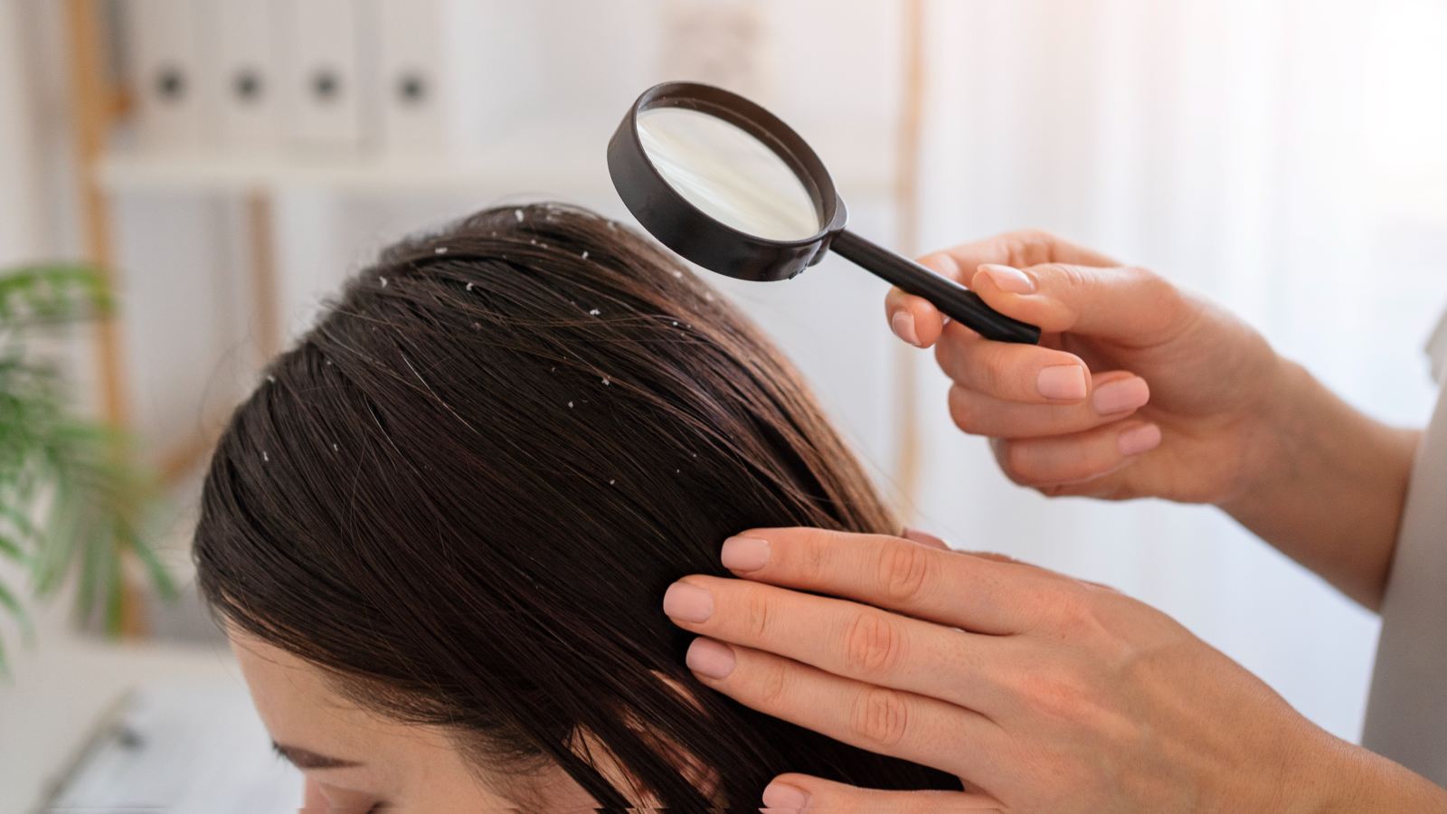 Home remedy for dandruff: Use egg and yogurt hair mask