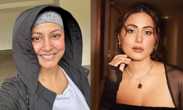 Hina Khan experiences eyelash loss as a side effect of chemotherapy