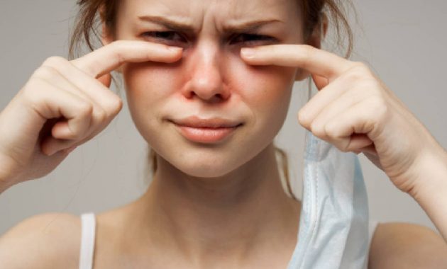 Are all eye infections contagious?